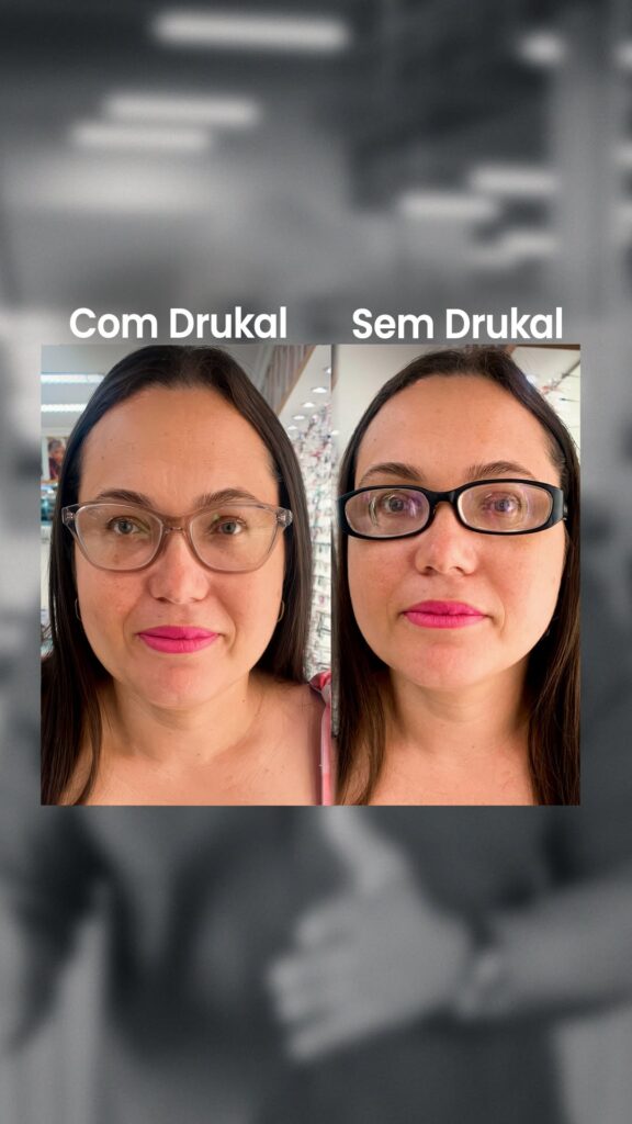 Alta dioptria não é só sobre enxergar bem. É sobre se sentir bem também 2 SaveClip.App 656168572 17879470857536513 6588630764783552235 n